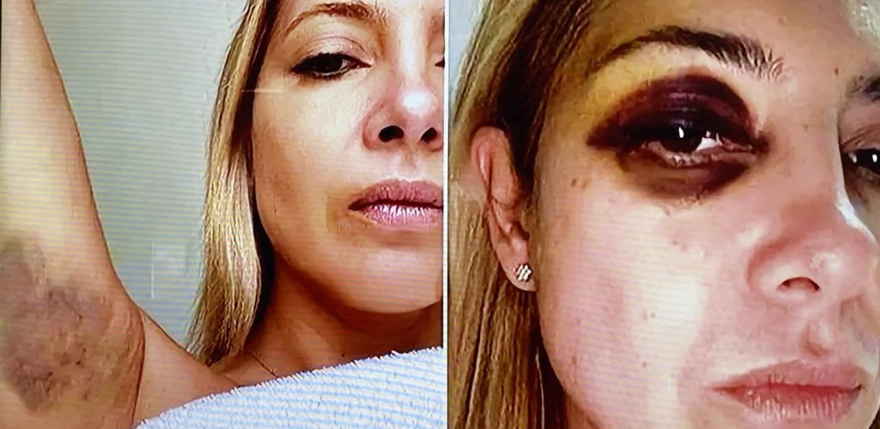 Denuncia a Alberto: difundieron fotos de Fabiola Yáñez golpeada y chats