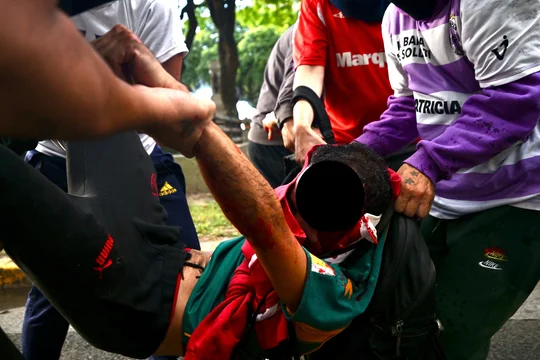 El fotógrafo agredido sigue en terapia intensiva, con pronóstico crítico
